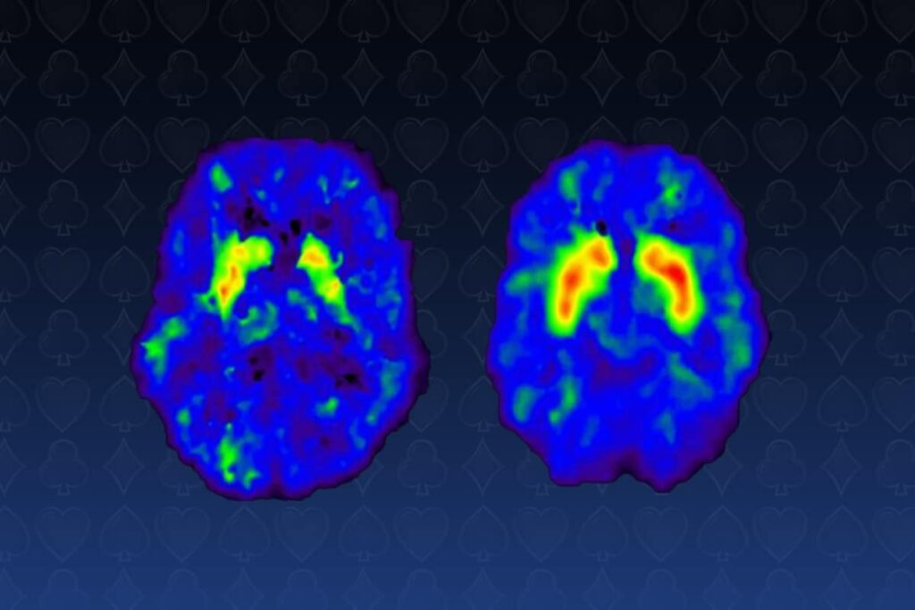 psychology of gambling